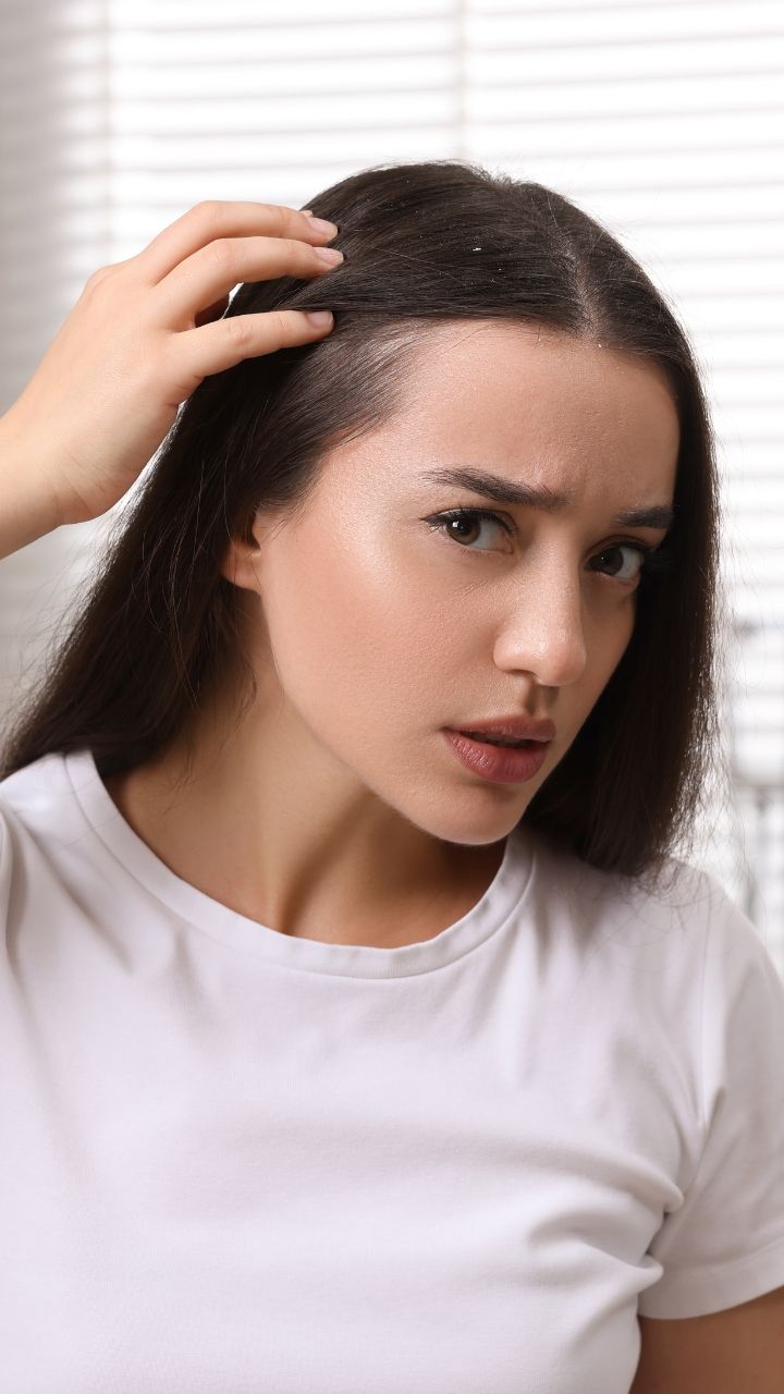 Anti-Hair Fall Therapy